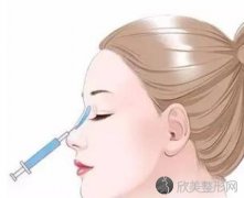 玻尿酸隆鼻效果怎么样？