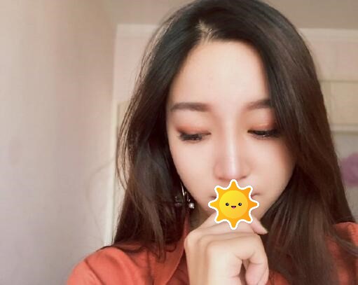 八大处张超面部脂肪修复好吗?隆鼻术后三个月真实野生反馈