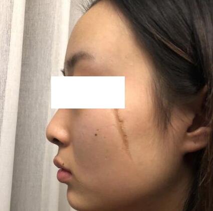 八大处北京八大处王连召手术怎么样?地址-价格在线查询