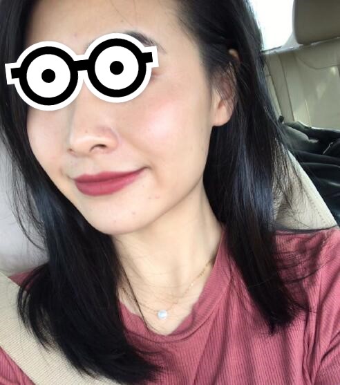北京八大处王连召除疤是激光吗 水光针附收费标准 欣美整形
