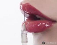 玻尿酸注射丰唇的实际效果好不好？