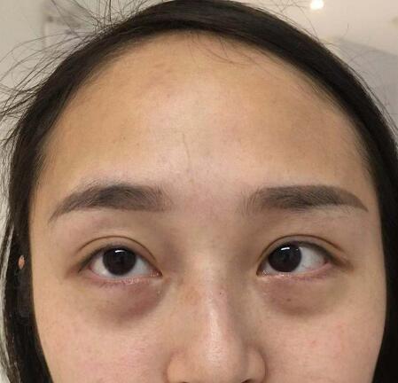 八大处王千文怎么样?水光针附收费标准