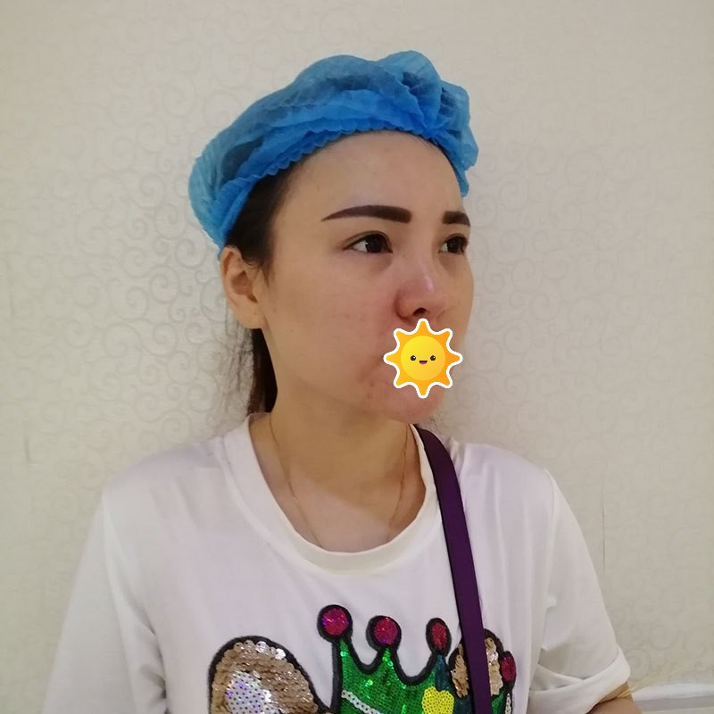 八大处周传德打水光针怎么样?双眼皮地址-价格在线查询