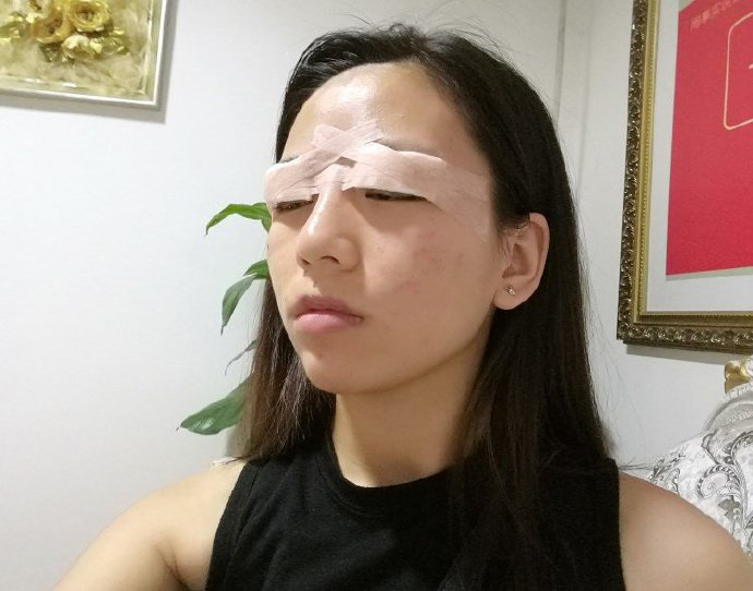 八大处医院双眼皮都乐怎么样?下颌角地址-价格在线查询