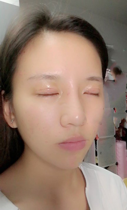 八大处医院双眼皮都乐怎么样?下颌角地址-价格在线查询