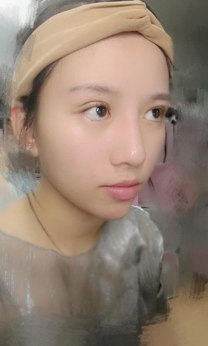 八大处医院双眼皮都乐怎么样?下颌角地址-价格在线查询