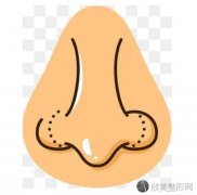 整过鼻子的人后悔吗？