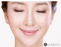 面部吸脂做完10天图片分享~快来看效果怎么样？