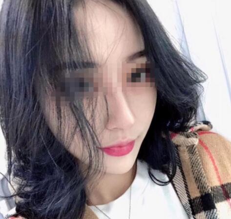 北大崔永言取生长因子怎么样?水光针术前术后图