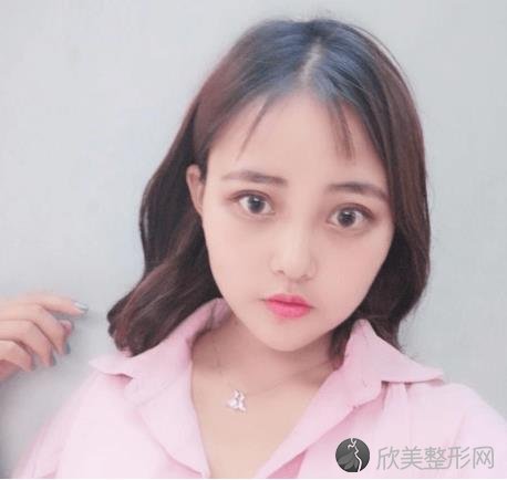 湛江中心人民医院整形科究竟好不好？-内附双眼皮恢复过程图一览