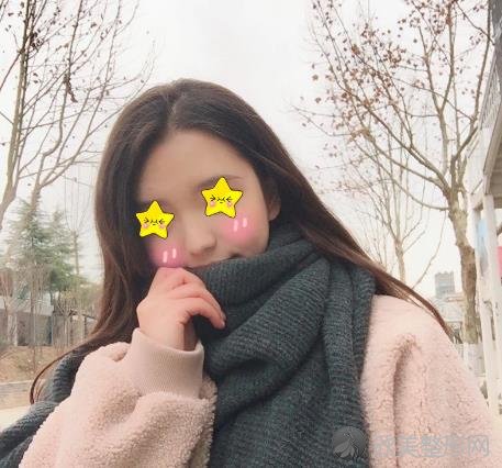 南京美莱赵其中鼻修复技术怎么样呢？来看看案例术后恢复照片就知道了