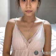 小姐姐假体隆胸手术三个月前后照片及术后注意事项