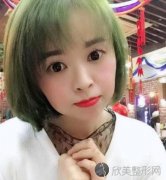 杭州绽美整形医院怎么样？医院介绍+眼综合后90天效果图