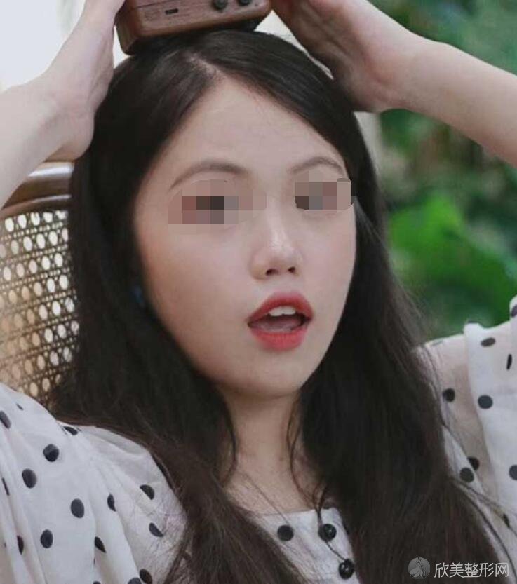牙齿美白术前