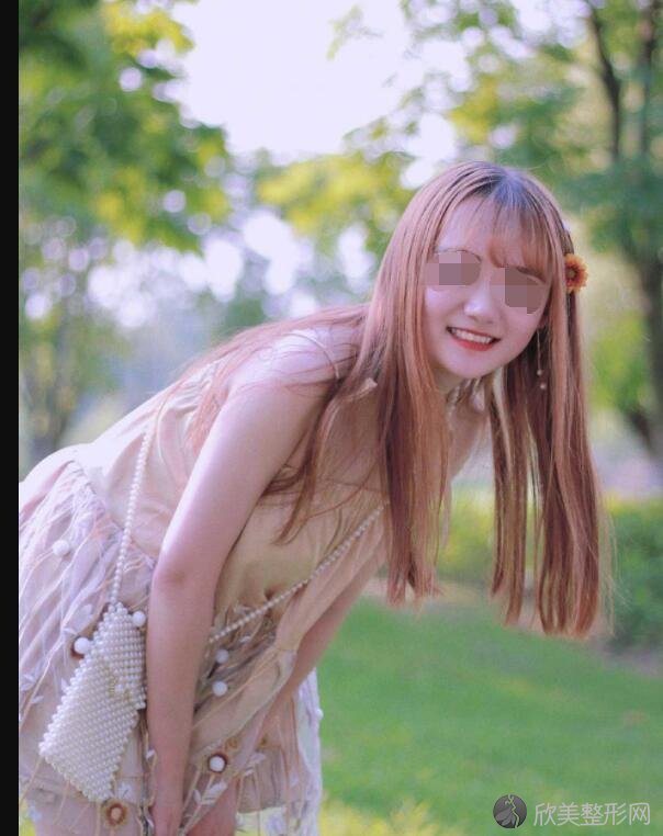牙齿美白术后20天