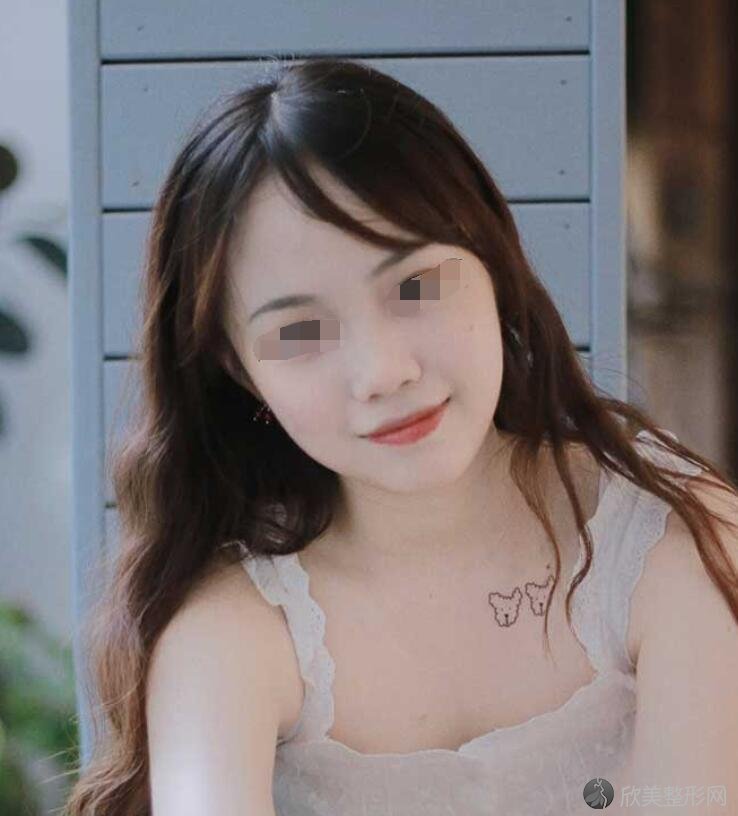 牙齿美白术后30天