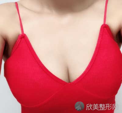 北京艺星薛轶群医生做自体脂肪隆胸真实案例分享，术后对比效果图