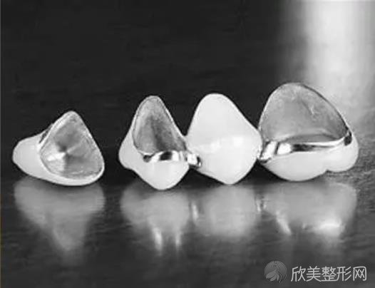 纯钛合金烤瓷牙是什么？此类烤瓷牙优缺点有哪些？