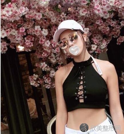 腰腹吸脂术后20天
