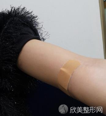 浙医二院整形科全身吸脂手术怎么样？内附真实案例不要错过~