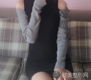 浙医二院整形科全身吸脂手术怎么样？内附真实案例不要错过~
