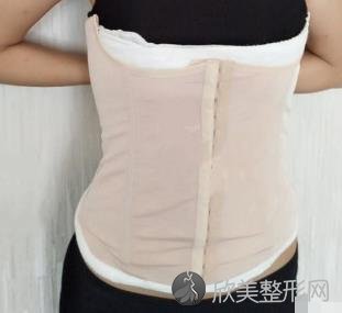 长沙爱思特整形医院吸脂手术怎么样？内附真实案例不要错过哦~