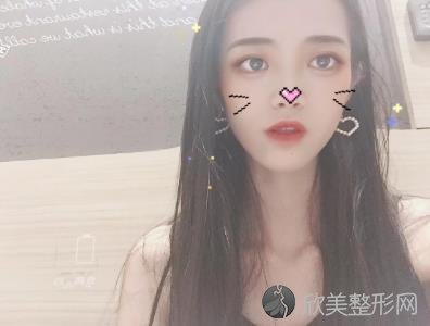 山西医科大学医院整形美容科自体脂肪面部填充手术怎么样？内附真实案例-价
