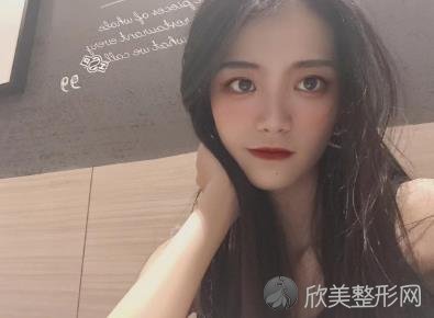 山西医科大学医院整形美容科自体脂肪面部填充手术怎么样？内附真实案例-价