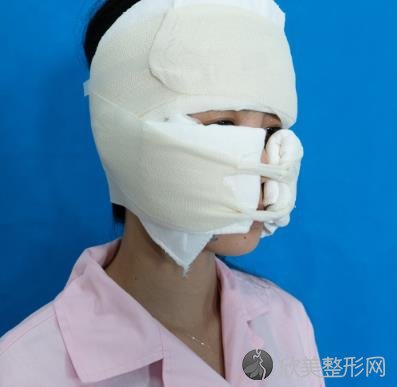 山西医科大学医院整形美容科自体脂肪面部填充手术怎么样？内附真实案例-价