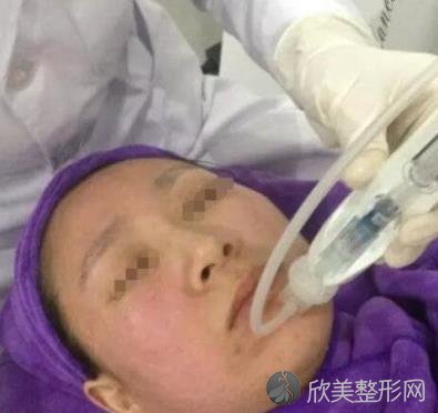 八大处唐勇脂肪填充做得好吗？内附案例前后对⽐照2021年价格表