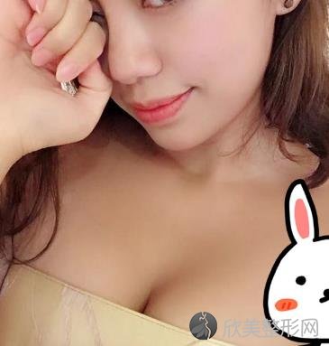 八大处刘春军隆胸手术做的怎么样？内附真实案例价格表⼀览
