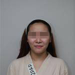 <a href='https://www.joshreso.com/project/696.html' target='_blank'><u>自体脂肪丰面颊</u></a>让我的状态越来越好皮肤也水嫩水嫩的
