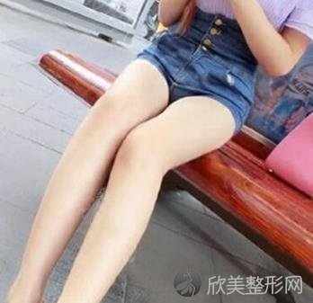 上海华山医院抽脂瘦腿怎么样？内附真实案例+价格表