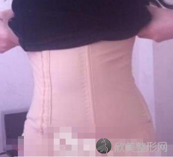 武汉同济医院整形科吸脂瘦身怎么样？内附案例一及价格表