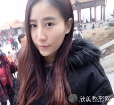北京艺美王东医生脂肪填充好不好？附真实效果图-价格表