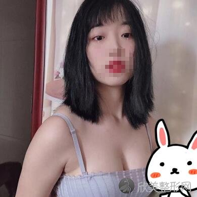 假体隆胸照片：丰胸美乳还是别寄希望于木瓜牛奶了