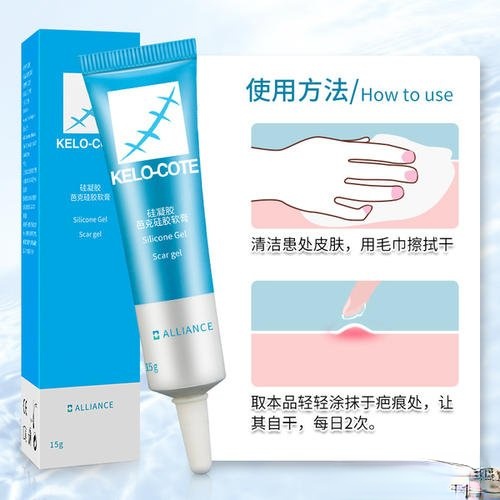 华西医院王杭医生科普双眼皮手术