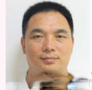 济南润境整形孟铸医生隆鼻技术怎么样可靠吗？真实经历分享