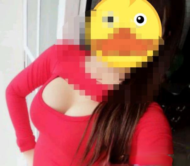 李弘基医生隆胸手术技术怎么样？前后图例分享~