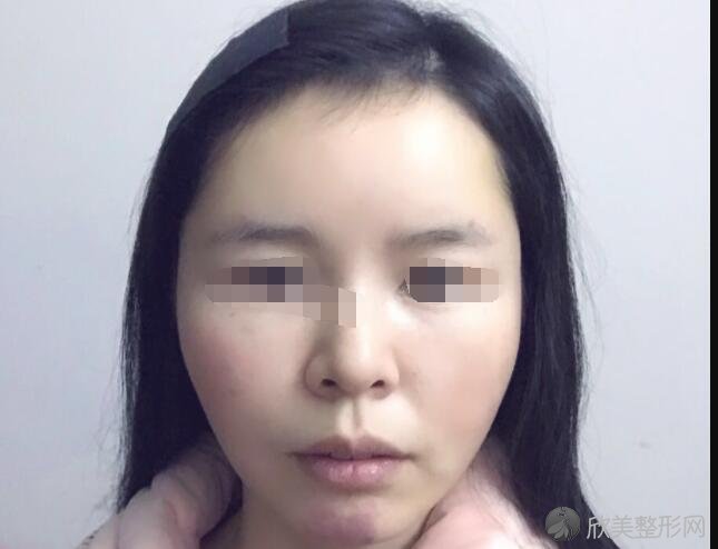 上海美蒂菲医疗整形医院电话是多少？做面部填充技术怎么样？