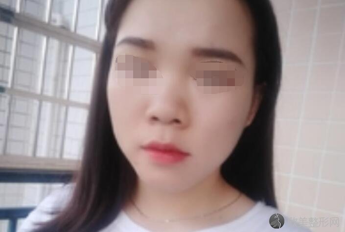 上海明桥整形医院口碑评价怎么样？治疗痤疮靠谱吗？