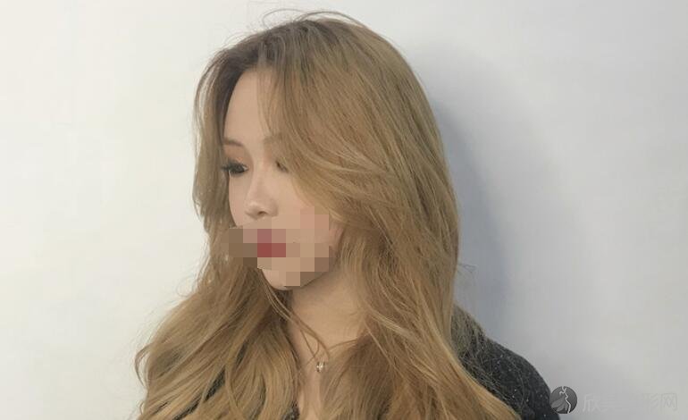 沈阳杏林美容院整形医院价格表公开！内附双眼皮案例介绍