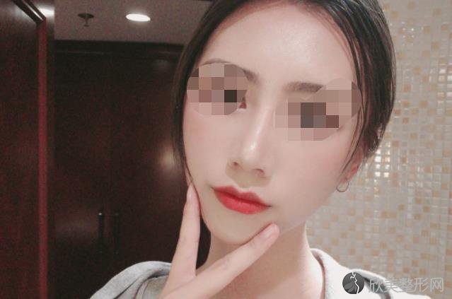 南京河西美容整形医院激光祛斑做的好吗？附案例分析和价格表！