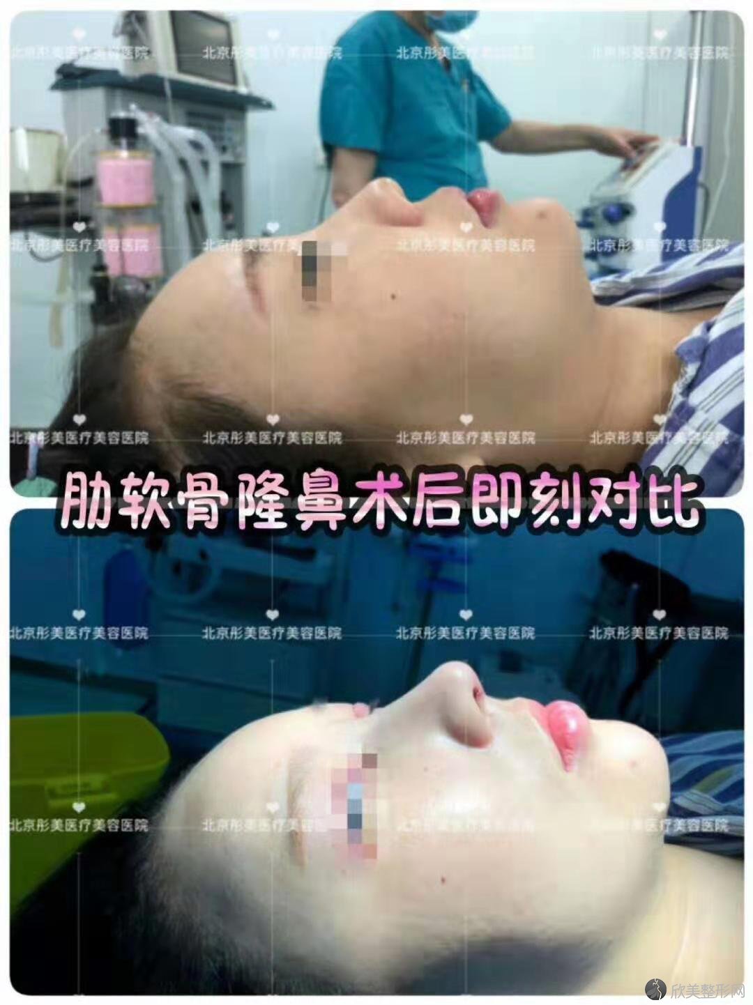 北京鼻子整形*好的医院有哪些？北京鼻综合医院排名预约