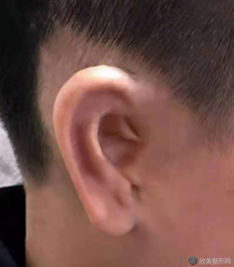重庆仁品耳鼻喉医院是正规医院吗？有小耳再造手术案例吗？