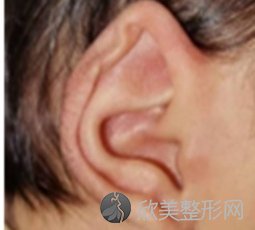 成都民生耳鼻喉专科医院耳再造怎么样？附案例分析及价格表