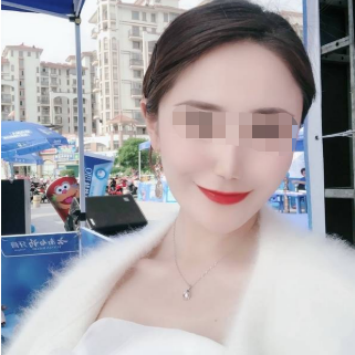 广东韩妃医疗美容医院黄蔚医生怎么样?吸脂瘦脸术后三个月真实野生反馈