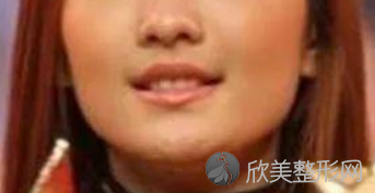 上海明桥整形医院怎么样？内附图片