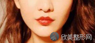 上海明桥整形医院怎么样？内附图片