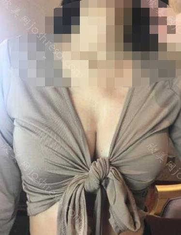 隆胸之后